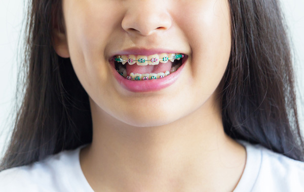 Why You Should Seek Out A Braces Specialist