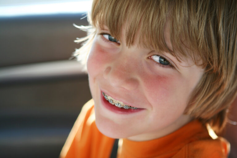 young smiling male patient wearing braces