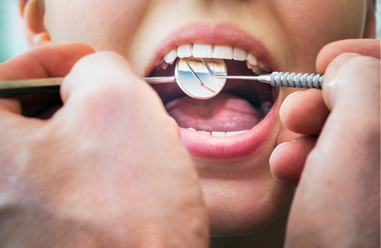 Fixed Retainers