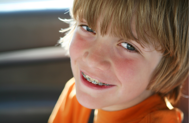 Kid wearing an orange shirt smiling revealing his braces