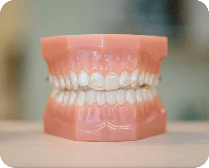 What Are Retainers And Why Do You Need Them