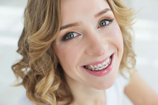 Tips For Flossing With Braces