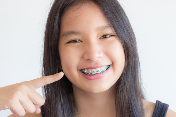 Questions To Ask Your Orthodontist About Braces