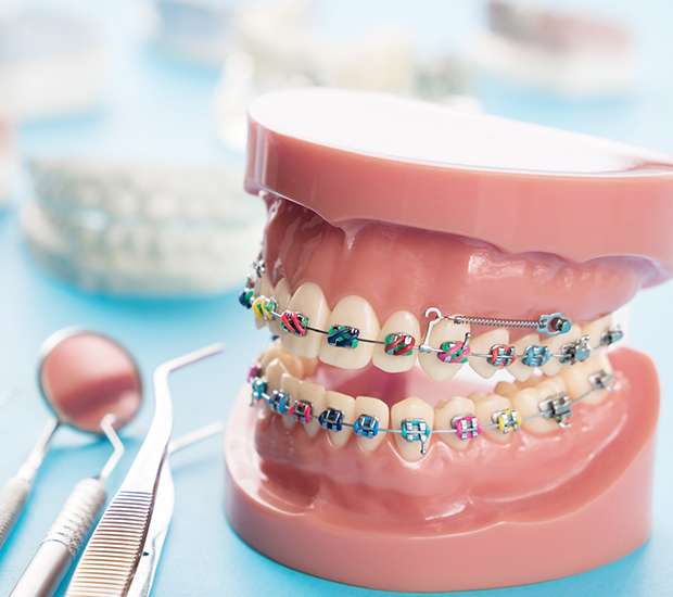 The Chemistry of Orthodontics - Cleveland Orthodontics in