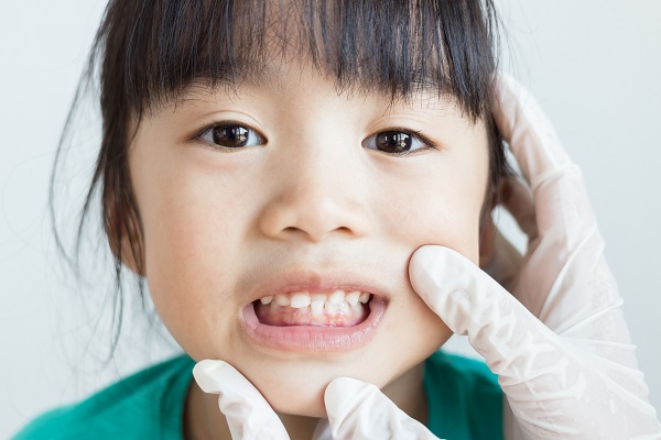 A Pediatric Orthodontist Shares Helpful Information On Permanent Teeth